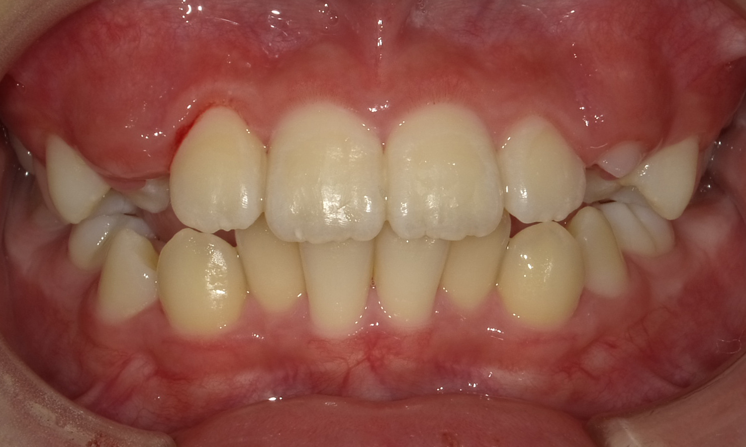 SHOFU DENTAL DIGITAL CAMERA｜文京区の矯正歯科 スマイルプレイス本郷矯正歯科